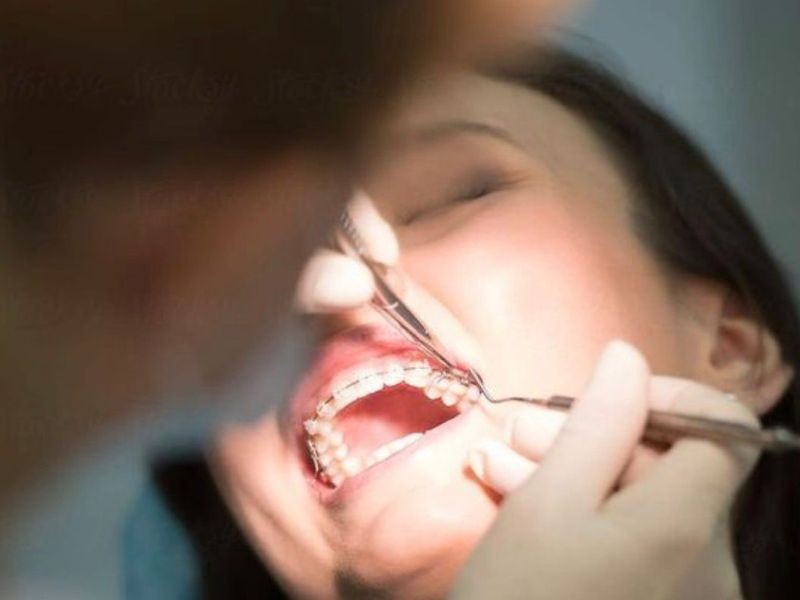 Dentista para atendimento de urgência 24 horas em Goiânia. Por que é tão importante?