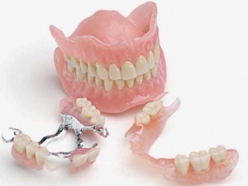 O que é uma prótese dentária e quando é indicada?