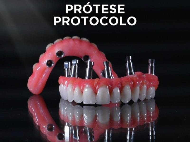 Prótese Protocolo: O que é, Como Funciona e Quem Pode Fazer