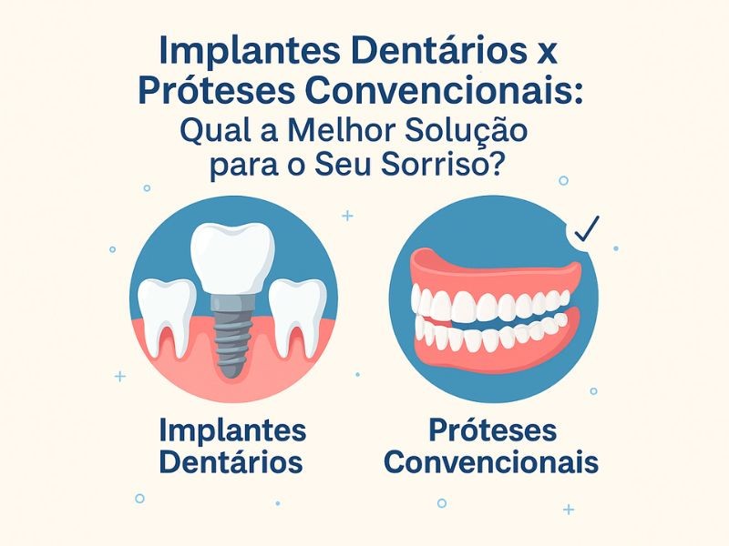 Implantes Dentários x Próteses Convencionais: Qual a Melhor Solução para o Seu Sorriso?