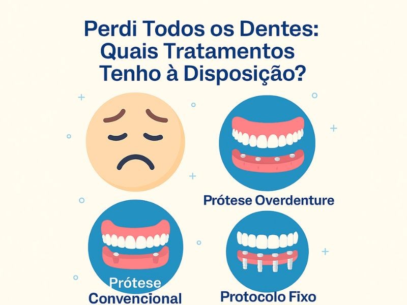Perdi Todos os Dentes: Quais Tratamentos Tenho à Disposição?