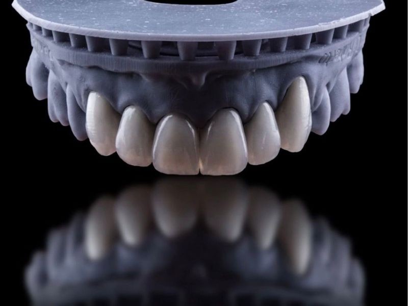 Facetas dentárias mancham ou quebram? Saiba como evitar danos e manter o sorriso por anos